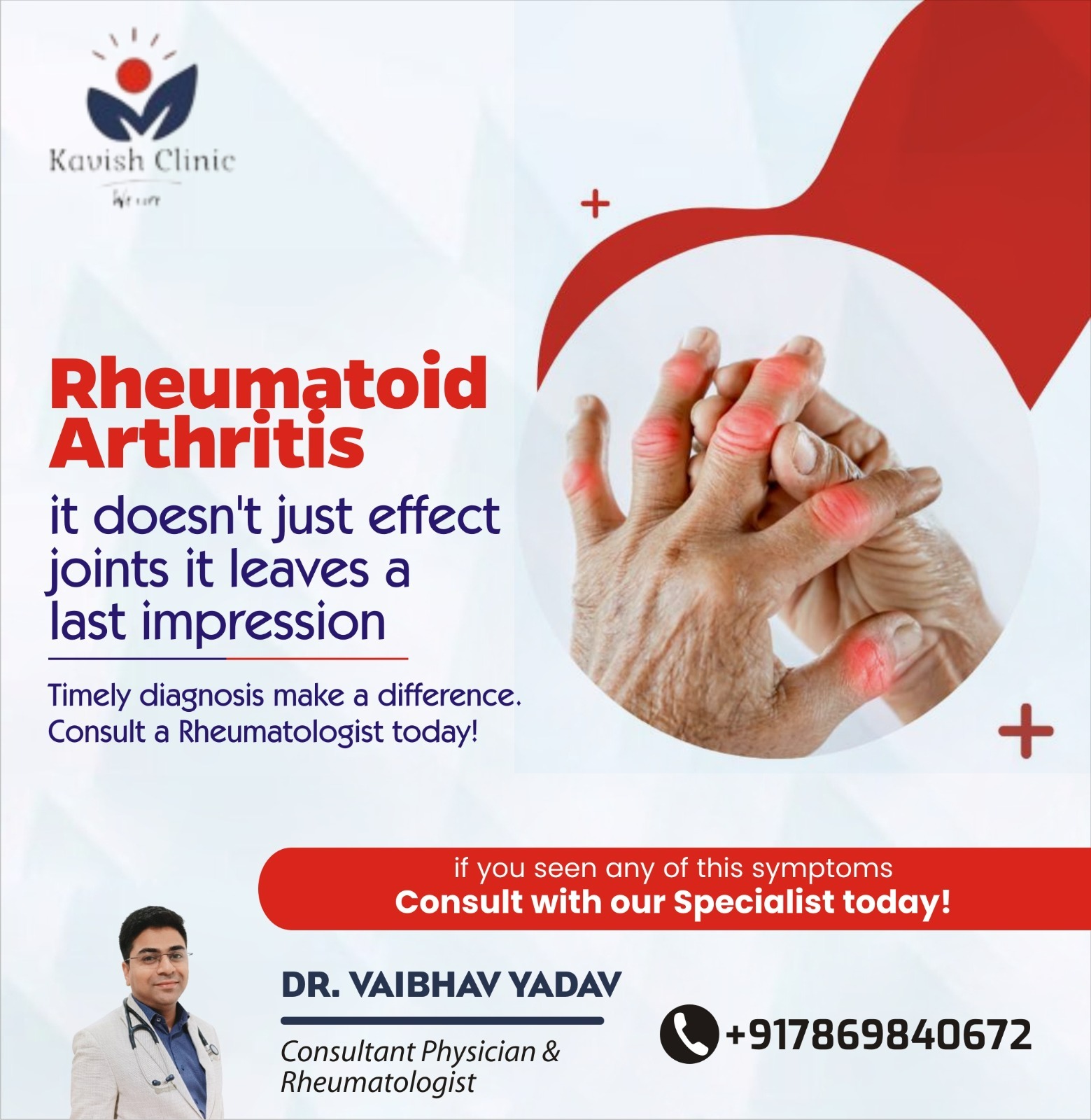 Rheumatoid Arthritis Treatment in Indore